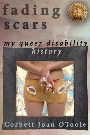 Photo of a light skinned body wearing shorts and hand splints made from brown latex. Model and image by Sandie Yi (disabled). Black textured boxes surround the photograph. Behind the images is a photograph of skin with scars. A Lambda Literary Finalist 2016 seal is on the upper right side.
