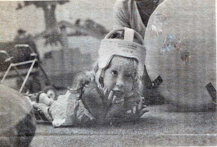 A black and white newspaper clipping of a young little curly-haired blonde, covered by a plastic helmet, lying on the floor on her stomach with her metal walker in the background. She holds her chin up with one of her hands and looks forward. There are physical therapy balls surrounding her.
