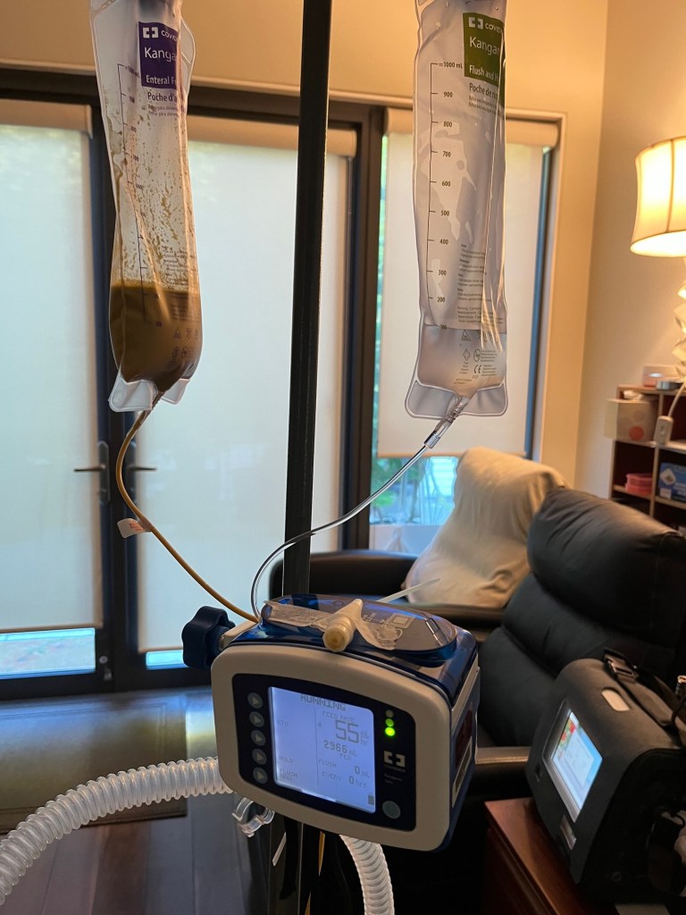In my living room, this is my feeding pump, a Kangaroo™ Joey Enteral Feeding Pump with a bag of food and a separate bag of water hanging on a pole with tubes connected to the pump. My vent tube is attached to the pole to support the weight of my trach which is SO heavy! On our side table, where we used to have other things, is my BiPAP that’s used outside of my bedroom, plugged into the wall.