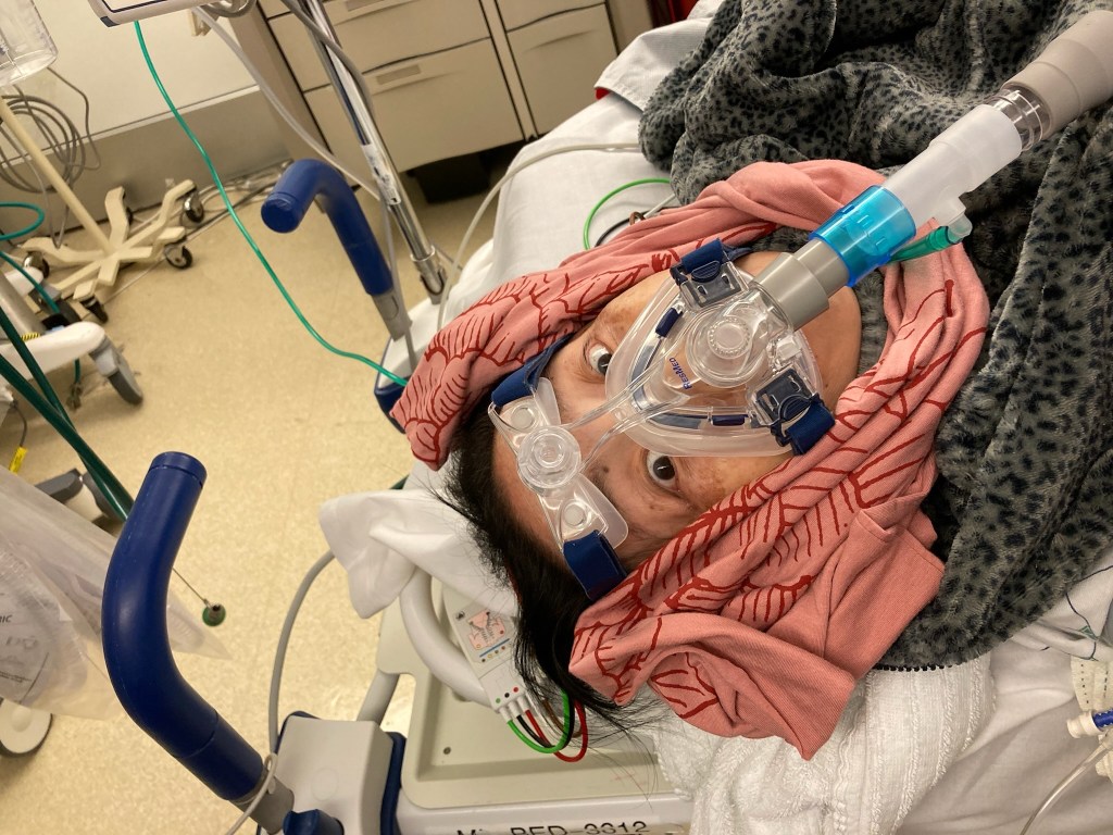 Photo taken on the first day entering the hospital. I am wearing a mask over my nose with my eyes wide open. It is freezing so I am bundled wearing a fleece jacket and a scarf wrapped around my face. I am laying in a hospital bed with no idea what the next month has in store for me.