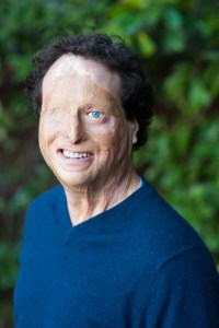 Photo of Josh Miele, a white man with curly brown hair. He has a blue left eye and scars covering his face and right eye. He is smiling at the camera and wearing a blue sweater. He is outside with greenery in the background.